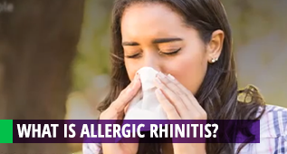 What is allergic rhinitis ?